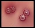 escherichia coli